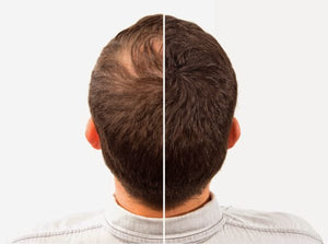 Caboki Hair Building Fibers , Hair Building Fibers Adds Volume To Thin Hair (copy)