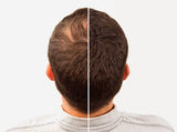 Caboki Hair Building Fibers , Hair Building Fibers Adds Volume To Thin Hair (copy)